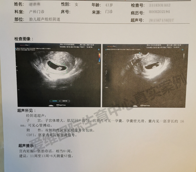 爱维国际生育中心试管婴儿成功案例